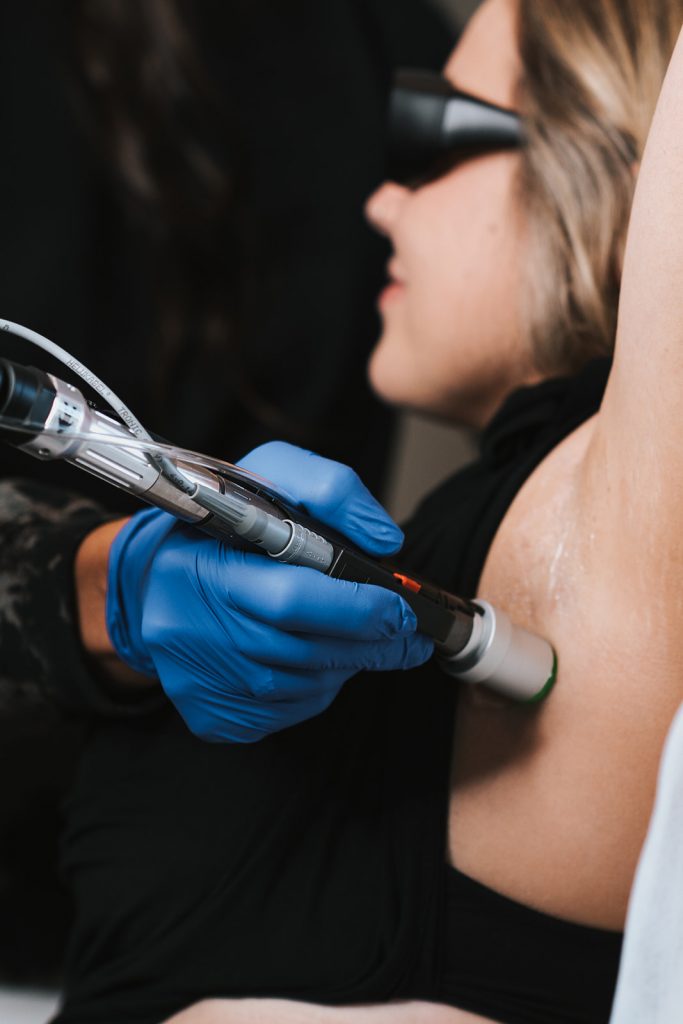 Laser Hair Removal