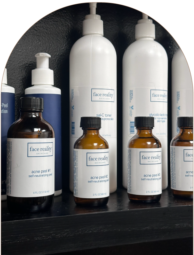 MD-Esthetics,-Approach-Acne