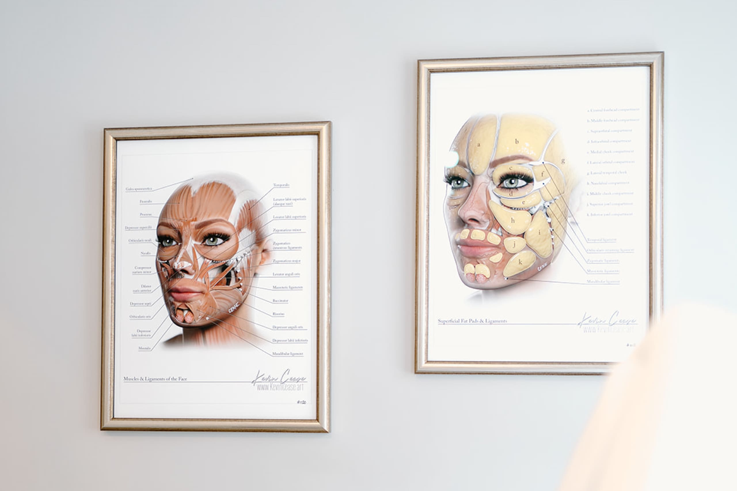 MD-Esthetics,-Dermal-Filler-Rejuvenate-2025-v2
