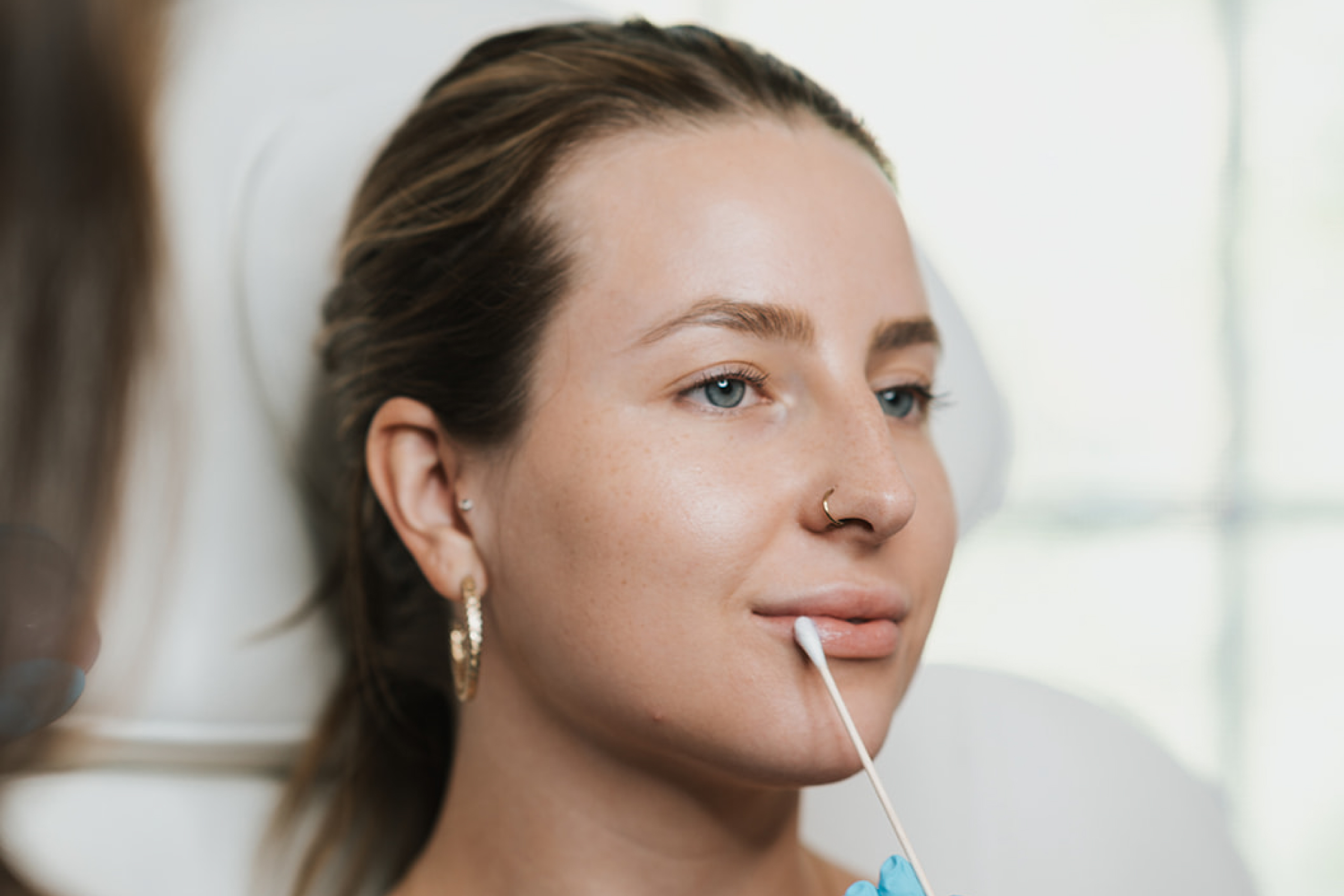 MD-Esthetics-Dermal-Fillers,-Aftercare-v2