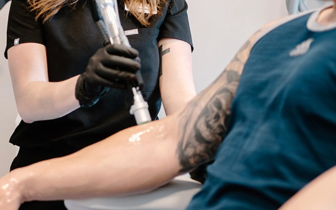 Laser Skin Treatments in Acton MA — Everything You Need to Know