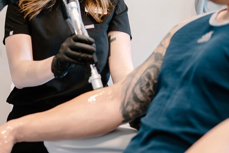 Laser Skin Treatments in Acton MA — Everything You Need to Know