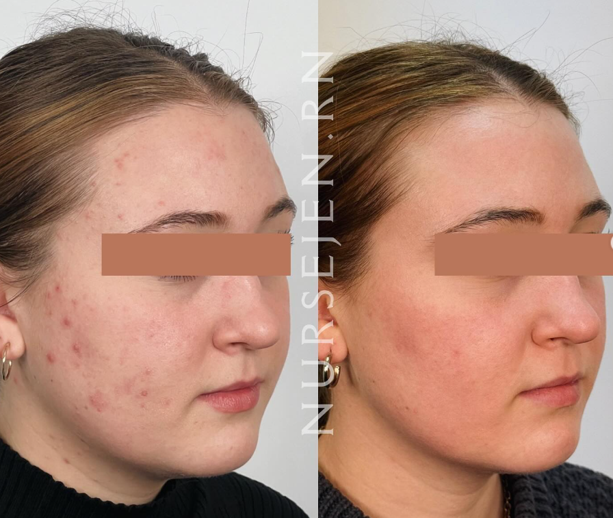 MD Esthetics CoolSculpting hero banner – redefine your shape effortlessly.