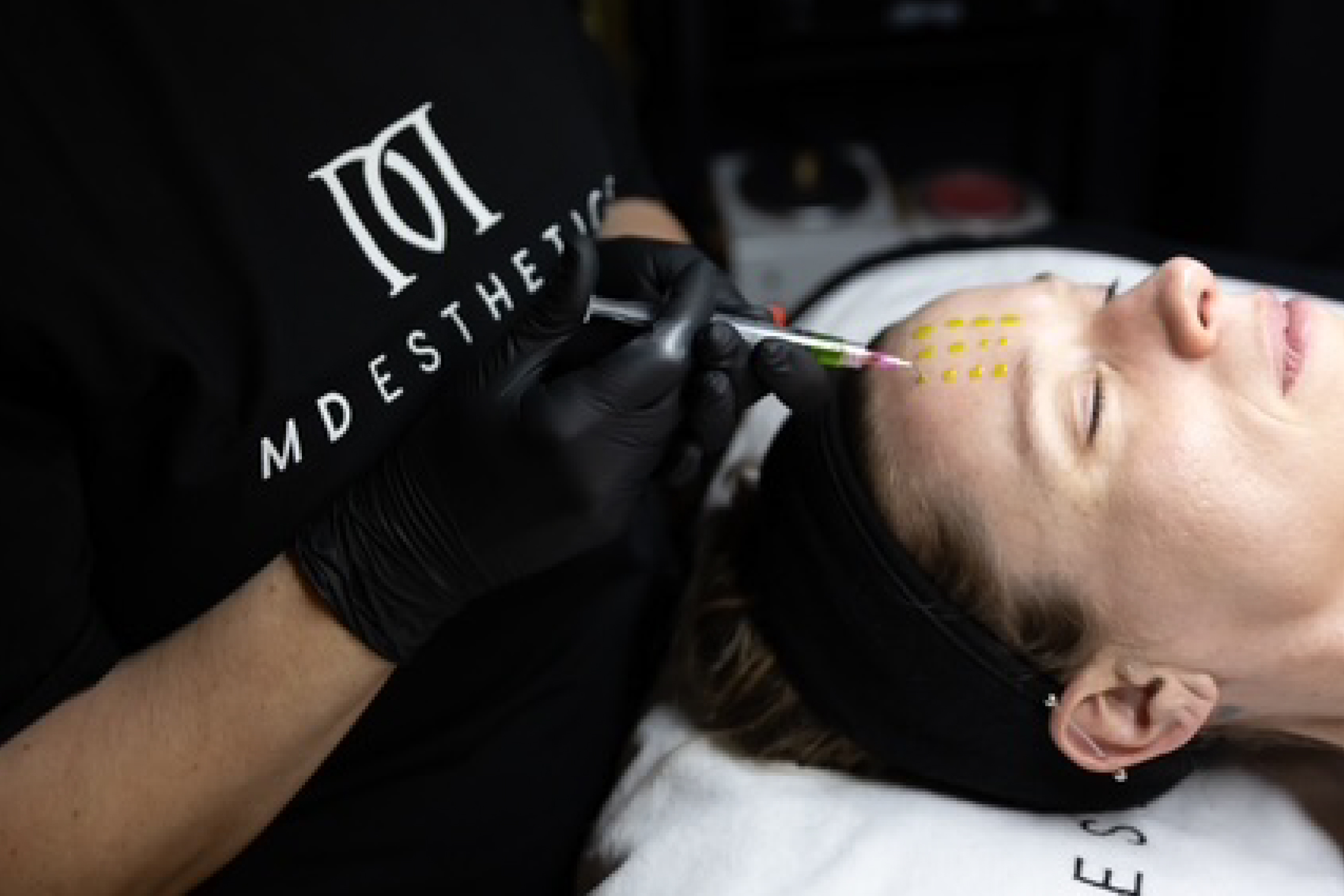 MD-Esthetics,-Transform-your-skin-Chemical-Peels