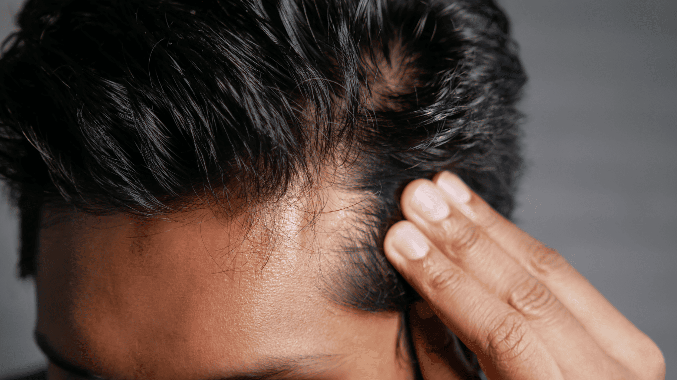 Md esthetics hair restoration
