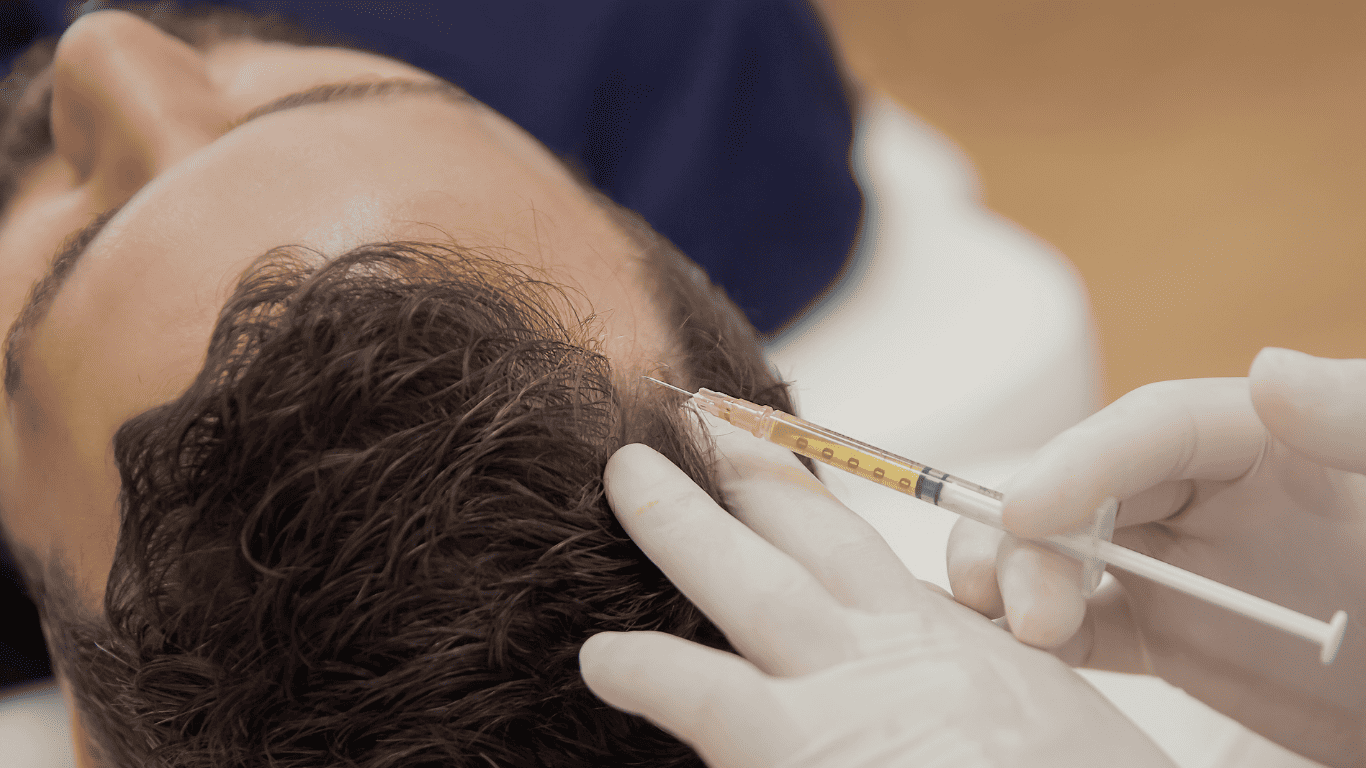 md esthetics hair restoration what to expect