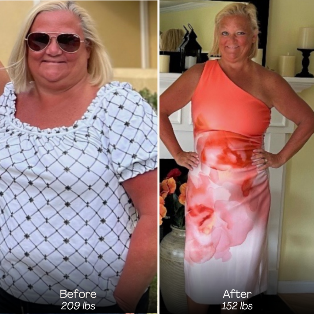 Before and after, patient 2