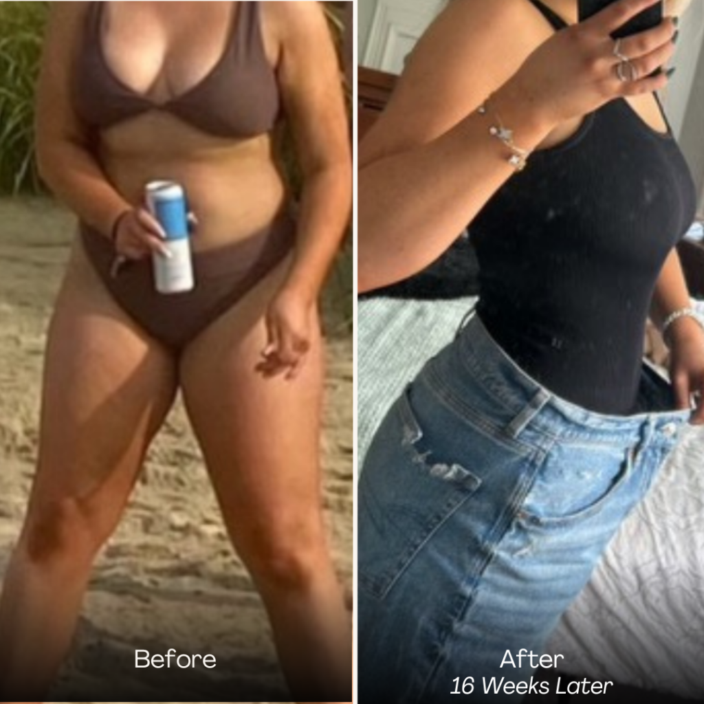 Before and after, patient 1