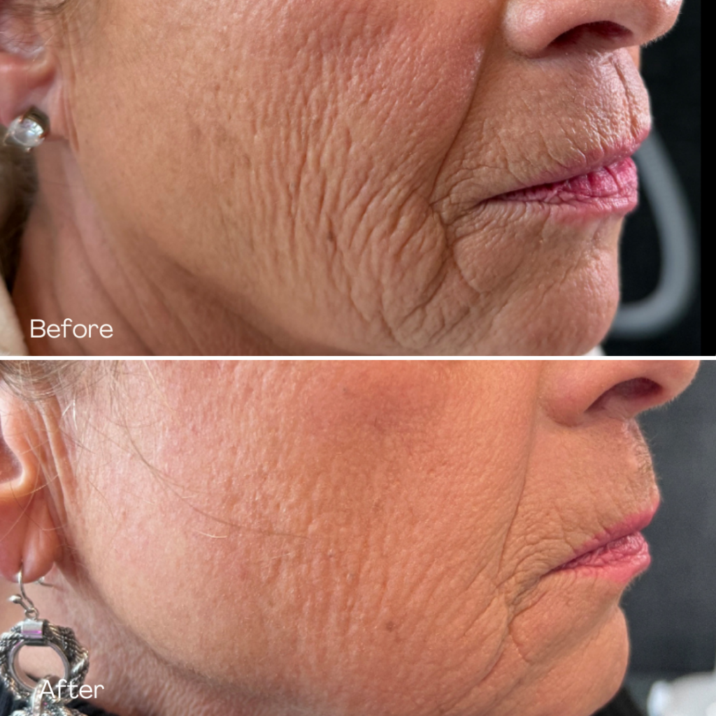 Before and after, patient 3