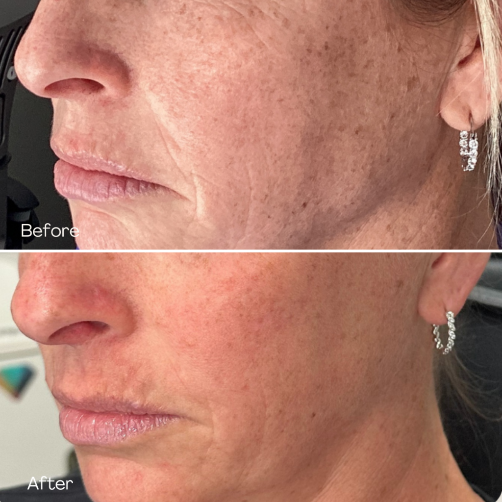 Before and after, patient 4