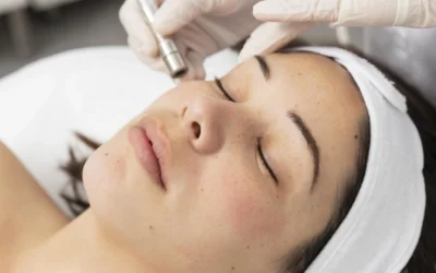 Microneedling Near Me — Why Peabody Residents Choose MD Esthetics